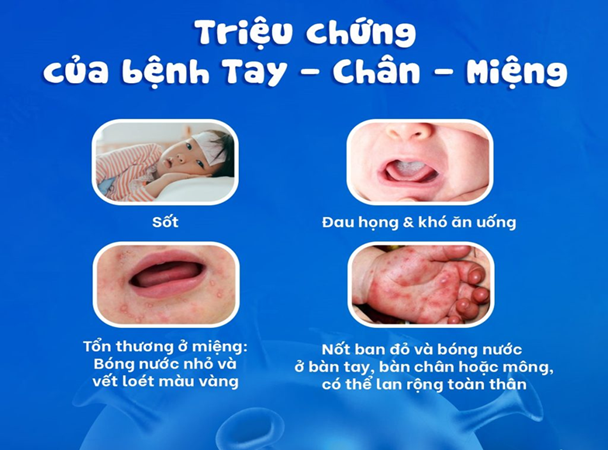CHỦ ĐỘNG PHÒNG, CHỐNG BỆNH TAY CHÂN MIỆNG
TẠI XÃ BÌNH PHÚ
